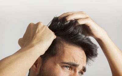 Classificazione della caduta dei capelli