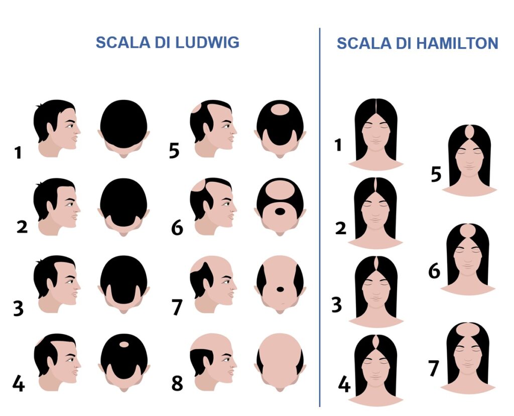 caduta dei capelli