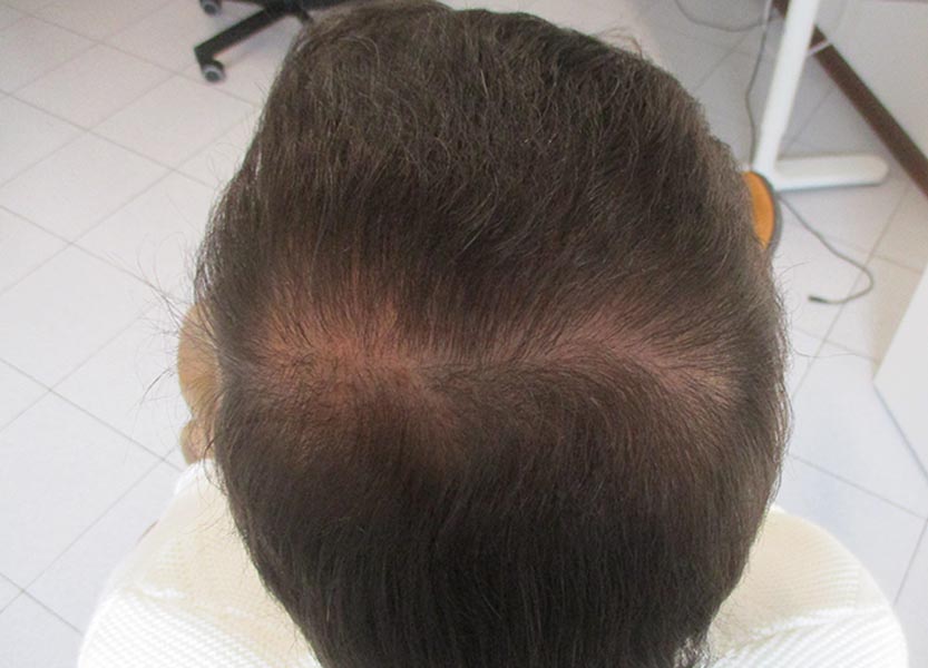 check-up capelli gratuito Reggio Emilia