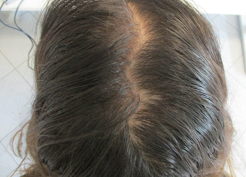 check-up capelli gratuito Reggio Emilia